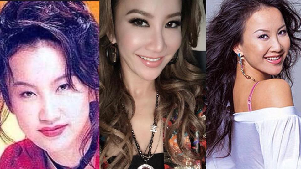 4位勇於承認整容的女星！變靚前後逐個睇  